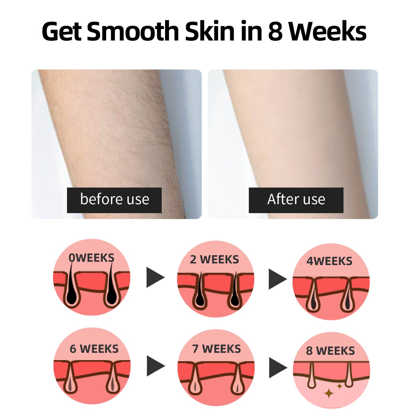 Hair with 28J Large Energy IPL Hair Removal Device